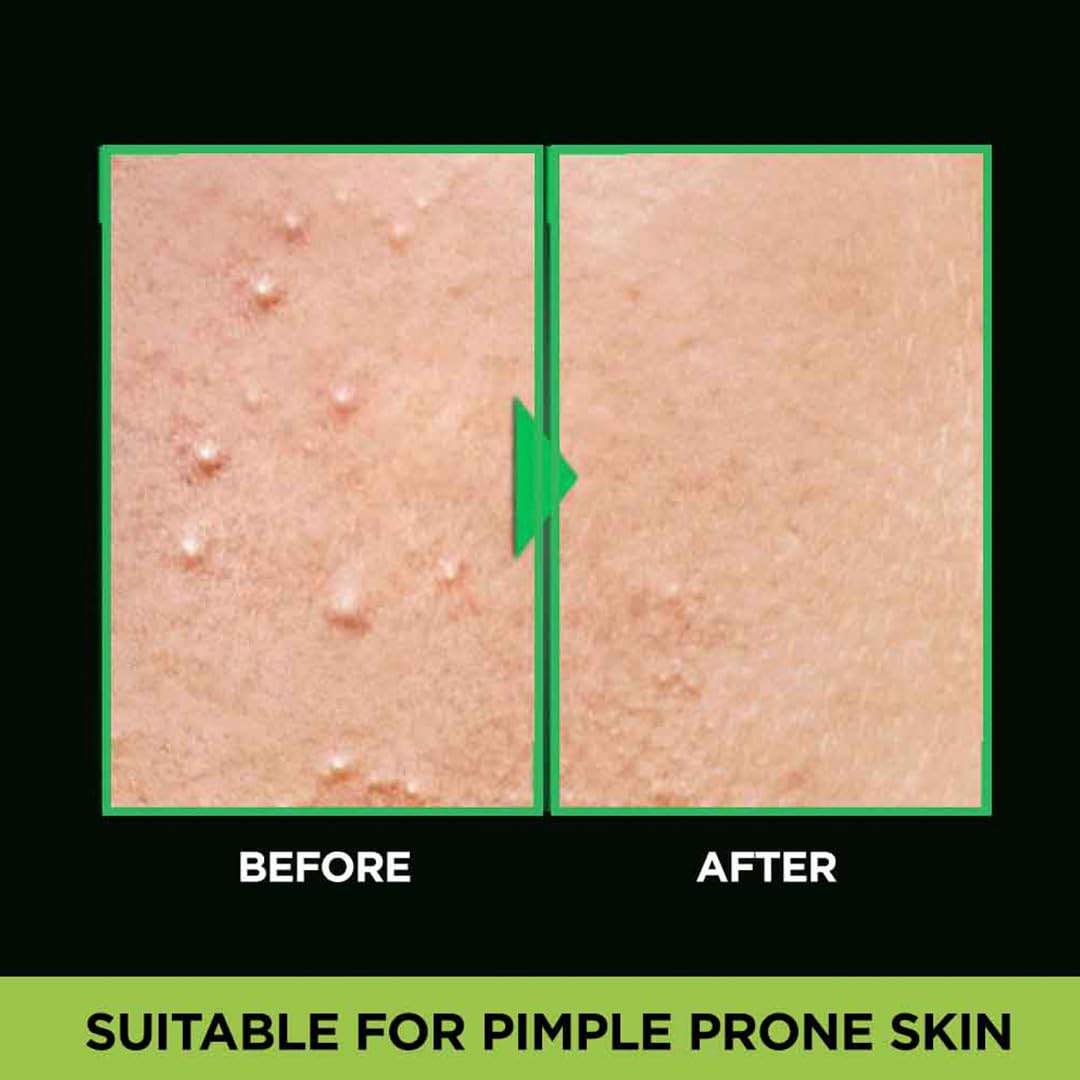 Garnier Men, Anti-Pimple Face Wash, Repairs Skin & Balances Oils, AcnoFight, 100 g