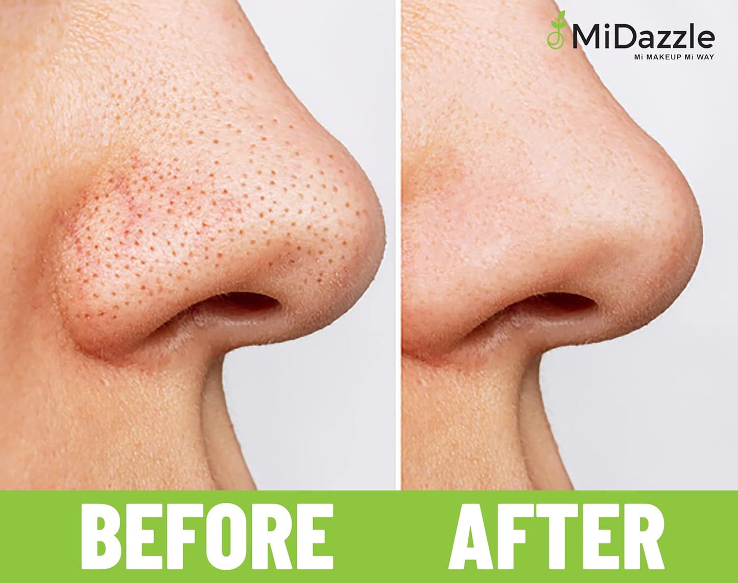 Midazzle Face Accessories (Tweezer + Blackhead Remover) - Combo Pack of 2