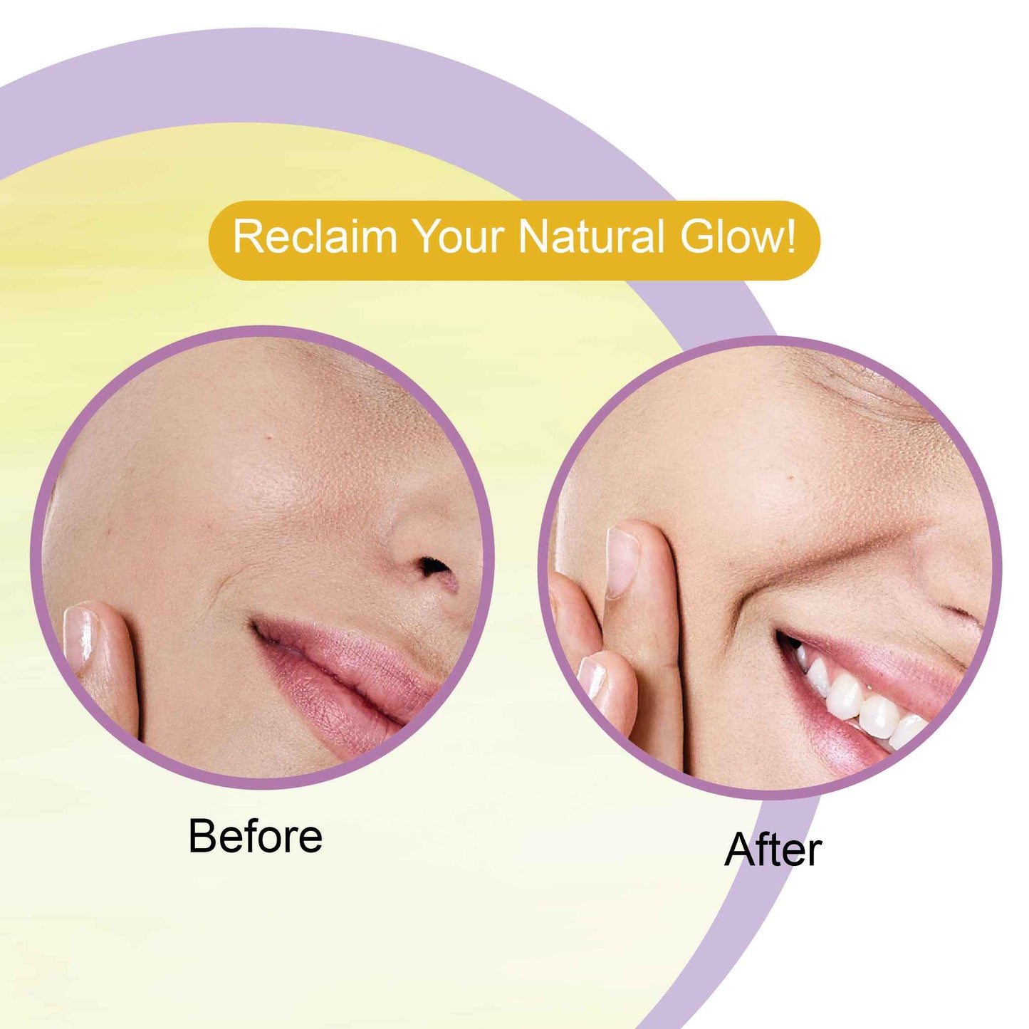 Dr.Rashel Detan Face Wash - 100 Ml